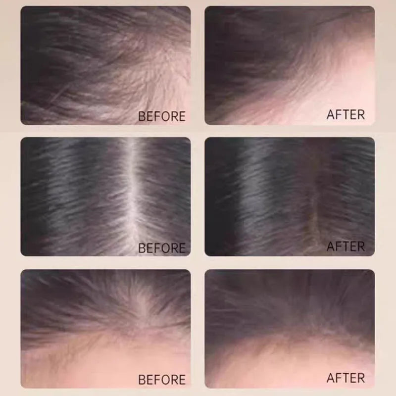 Plush Feeling Hairline Liquid Natural Wild Hairline Cover Cream Stick Waterproof Quick Filling Hair Styling Color Comestic